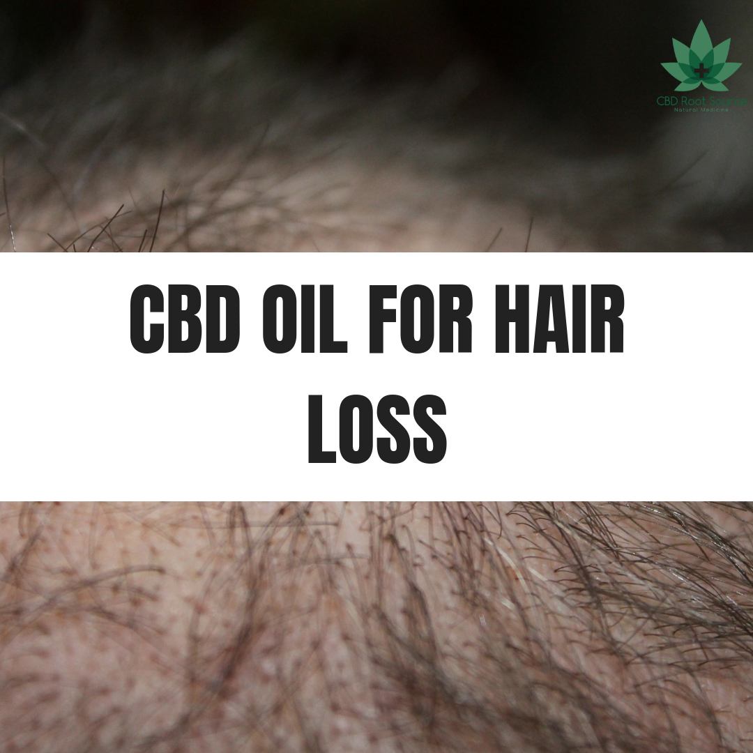 CBD Oil for Hair Growth and Hair Loss